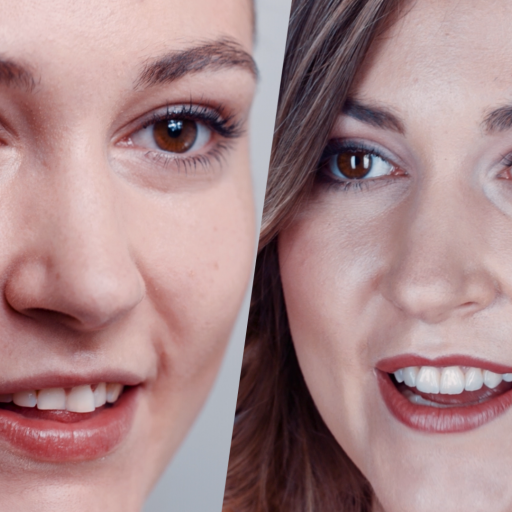 Beautiful smile again thanks to ceramic veneers